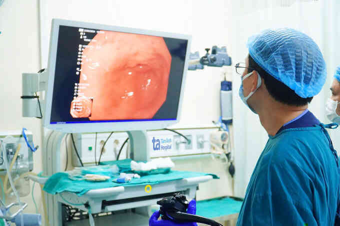 Sán lá gan chui lên ống mật