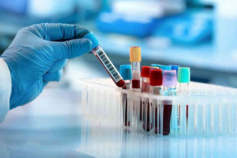 Người đàn ông đi cấp cứu nghi đột quỵ nhưng phát hiện ung thư giai đoạn cuối