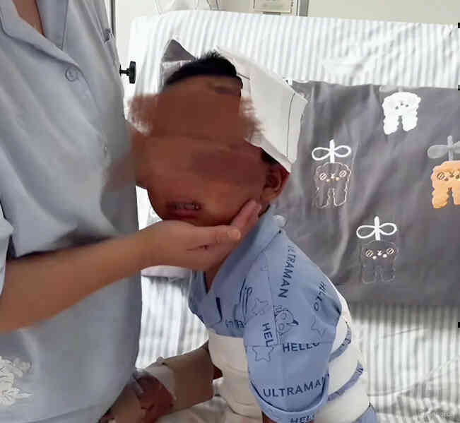 Học sinh lớp 1 chấn thương nặng vì bị xe tải chở đồ ăn của trường cán qua người