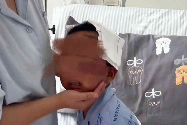 Tìm thấy nhiều dị vật trong vùng kín bé gái 5 tuổi