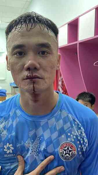 Cầu thủ hạng Nhất đánh nhau trong đường hầm sân Thống Nhất