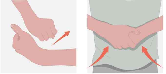 Cách sơ cứu trẻ hóc dị vật đường thở
