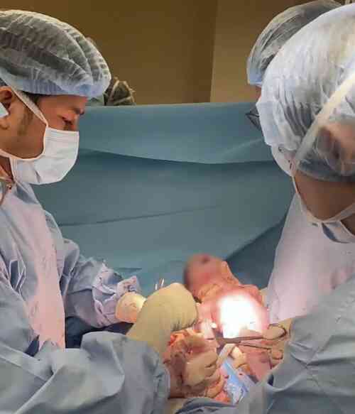 Em bé chào đời trong bọc u xơ tử cung 8 kg