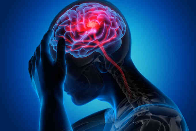 Xin về khi đang điều trị, cụ ông bị di chứng nhồi máu não nặng