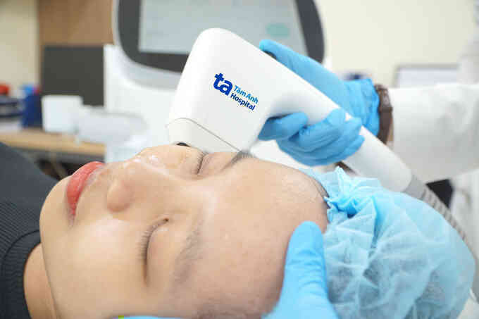 Các phương pháp cải thiện rãnh cười