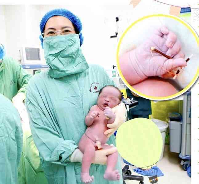 Bé trai chào đời cùng vòng tránh thai của mẹ