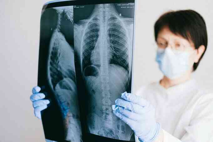 Bệnh hiếm khiến người phụ nữ xẹp phổi mỗi kỳ kinh nguyệt