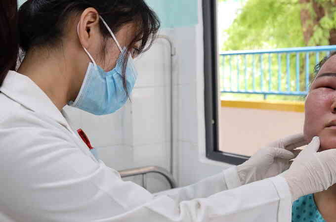 Gói hóa chất lột da trị tàn nhang khiến mặt cô gái bị viêm nhiễm
