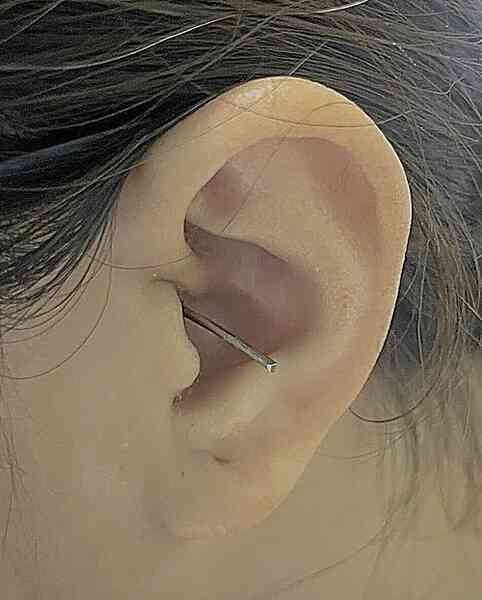 Dụng cụ lấy ráy tai đâm thủng màng nhĩ
