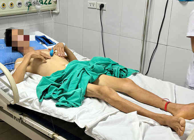 Suýt chết sau khi nhịn ăn, chỉ uống nước ion kiềm pha muối