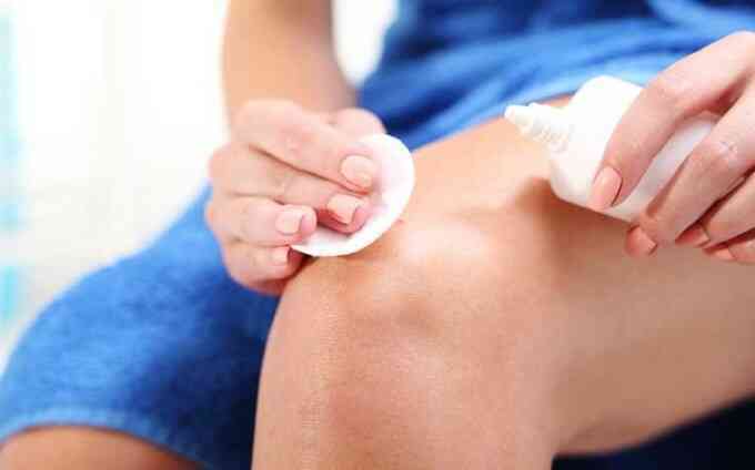 Cách xử lý vết thương phần mềm do va đập