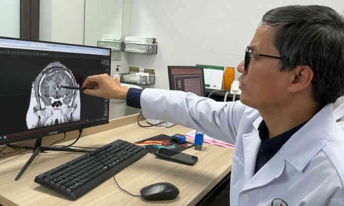 Phẫu thuật chặn gần 100 cơn động kinh mỗi ngày cho chàng trai