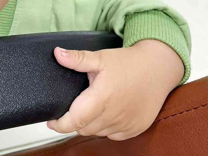Bé bị sọc đen ở móng tay có nguy hiểm không?