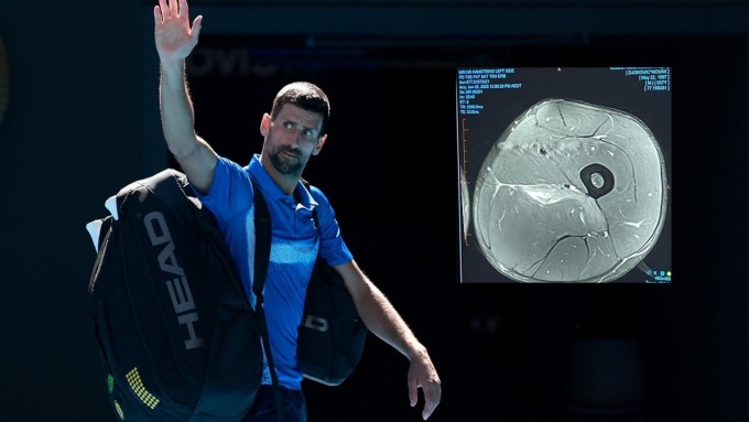 Djokovic công khai ảnh chụp chấn thương