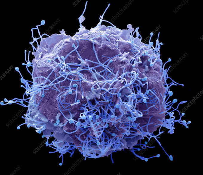 Virus đang lây lan ở Trung Quốc nguy hiểm thế nào
