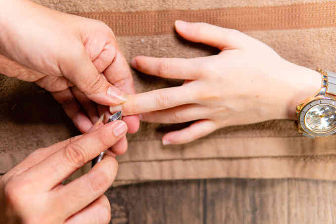 Làm đẹp không an toàn dễ mắc bệnh gì?