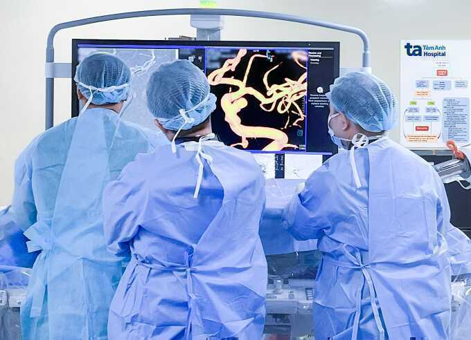 Can thiệp túi phình mạch máu cho người bệnh u não