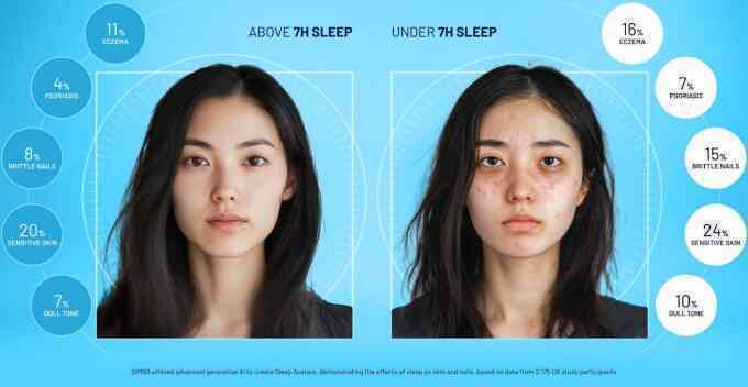 Ngoại hình thay đổi thế nào nếu thiếu ngủ