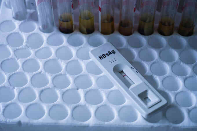 Tại sao cần xét nghiệm kháng thể trước khi tiêm vaccine viêm gan B?