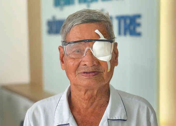 Bị bẹ dừa rơi trúng mắt rung rinh thủy tinh thể