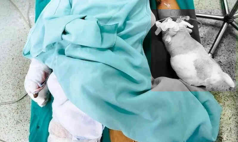 Học sinh lớp 6 nát bàn tay do chế tạo pháo