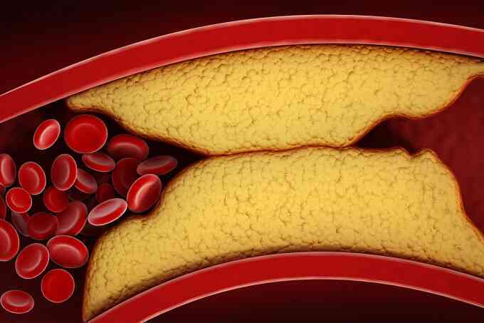 Phát triển thành công loại thuốc mới giúp giảm cholesterol
