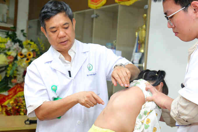 Gù vẹo cột sống biến chứng nặng nếu không can thiệp sớm