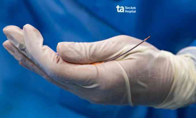 Các loại stent điều trị hẹp mạch vành, nhồi máu cơ tim