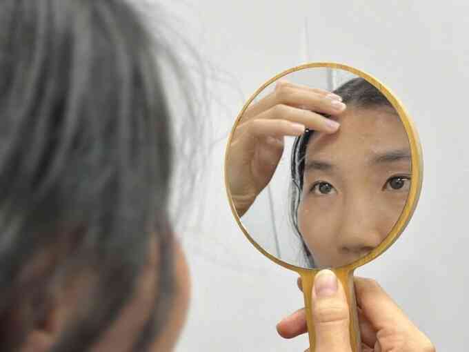Dấu hiệu stress trên da