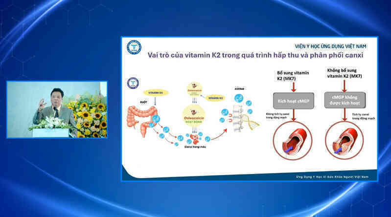 Thiếu vitamin K2 có thể khiến trẻ thấp hơn chiều cao tiềm năng