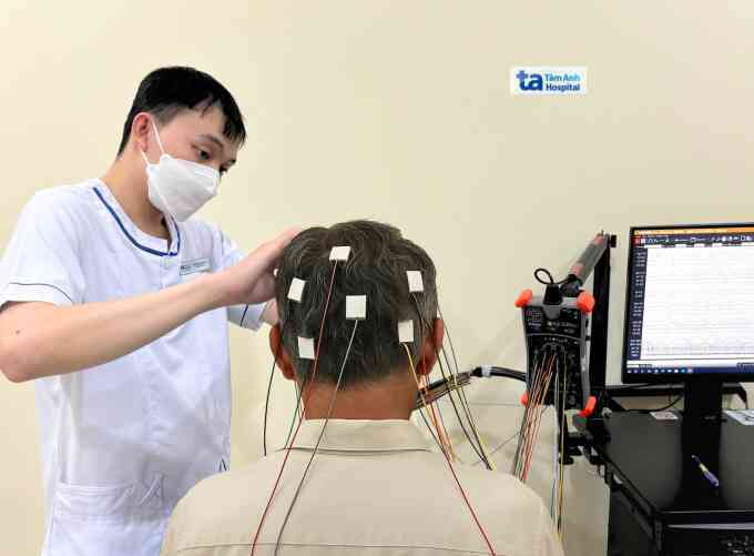 Dấu hiệu sa sút trí tuệ thể Lewy