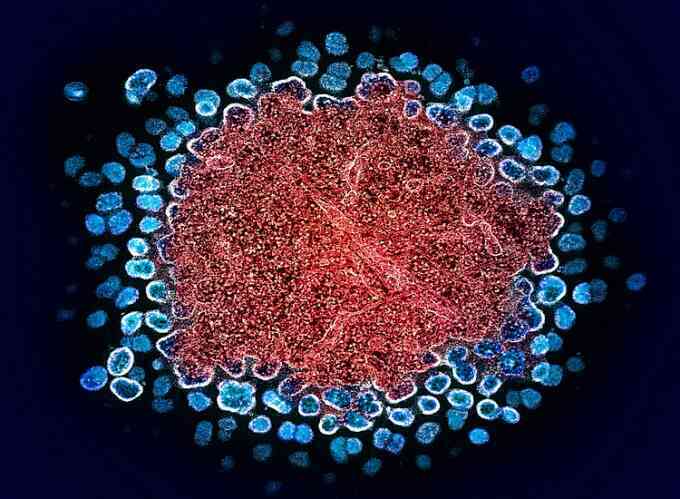 Vực dậy ý chí sống cho người bệnh HIV