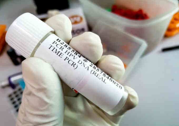 Ai có nguy cơ nhiễm HPV?