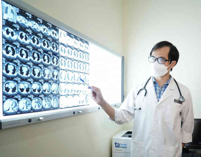 Nguy cơ viêm phổi khi nhiễm biến thể mới của Covid-19