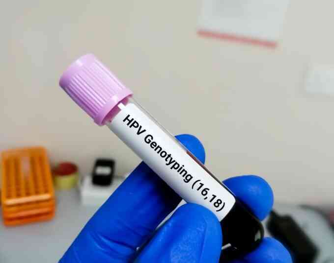 Những hiểu lầm nguy hiểm về HPV