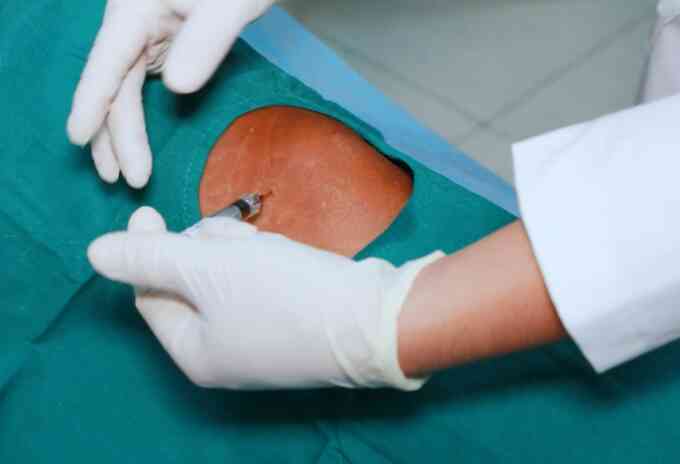 Tác dụng của tiêm khớp vai