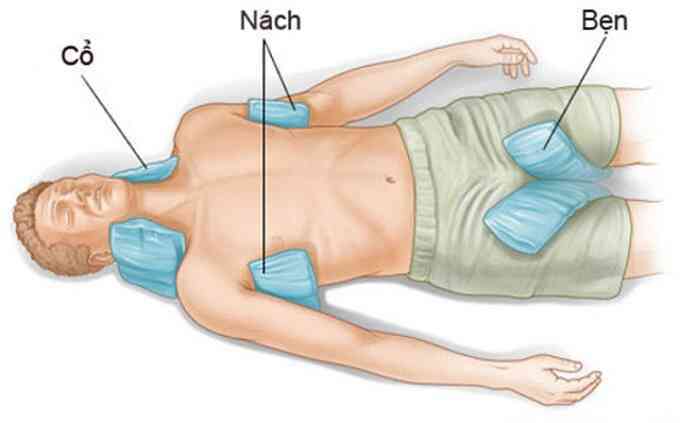 Nguy cơ rối loạn thần kinh, suy đa tạng bởi say nắng