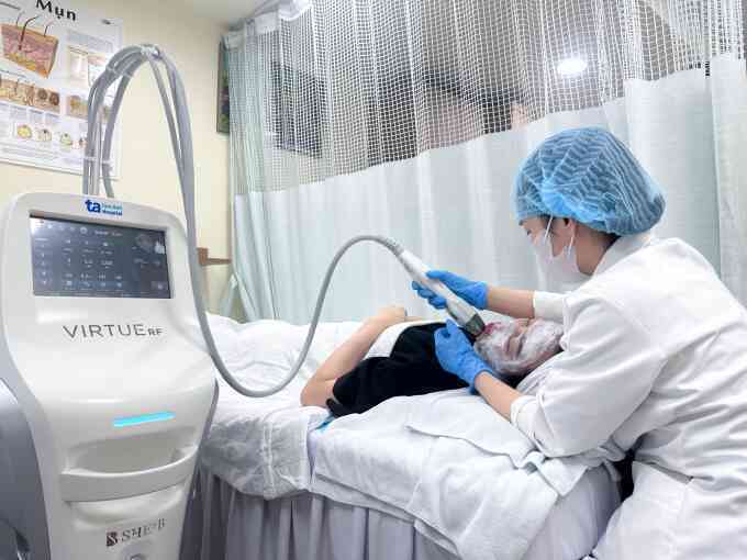 Có nên trị sẹo mụn bằng vi kim?