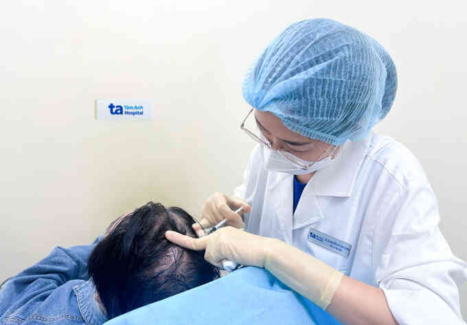 Tiêm meso chữa rụng tóc