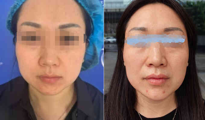 Người vợ giấu chồng vay tiền đi làm đẹp