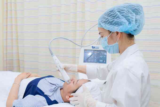 Trị mụn trứng cá bằng vi kim RF được không?