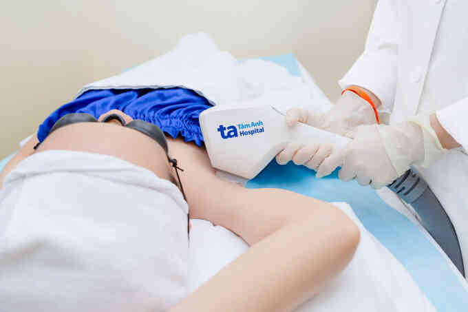Công nghệ IPL có triệt lông nách vĩnh viễn không?