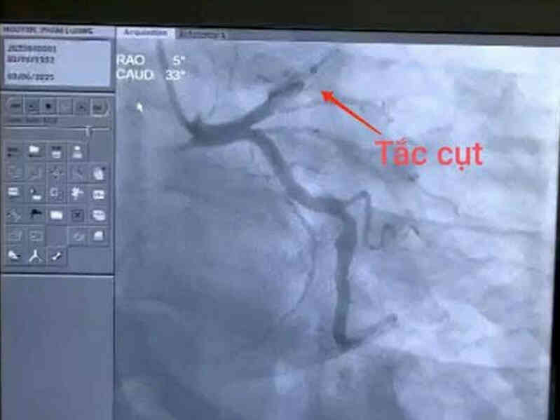 Bỏ qua thủ tục tài chính, bật báo động đỏ cứu người nguy kịch trên đường đi làm