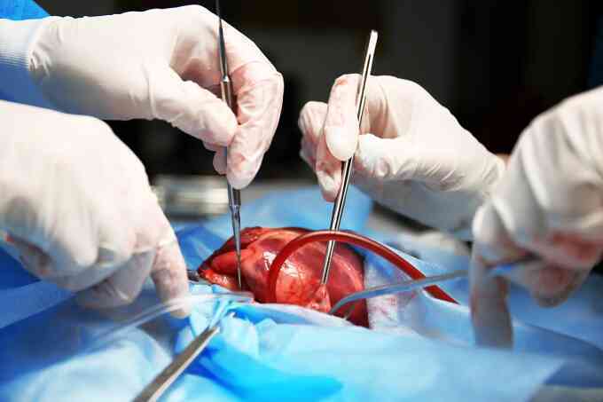 Tìm ra thêm cách bảo quản tim để cấy ghép