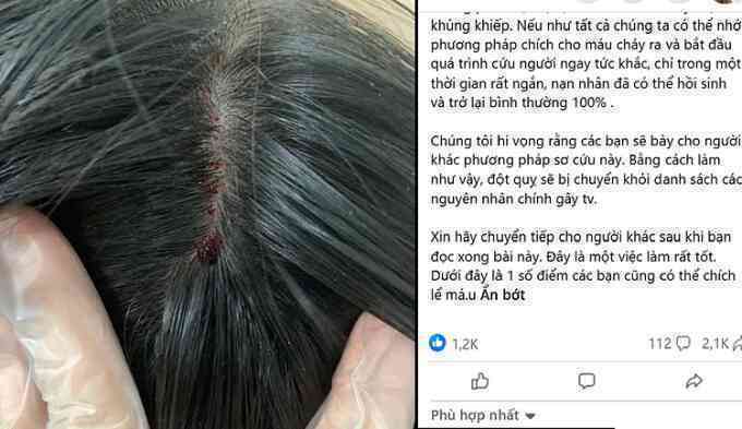 Cược mạng sống với lời đồn chích máu chữa đột quỵ