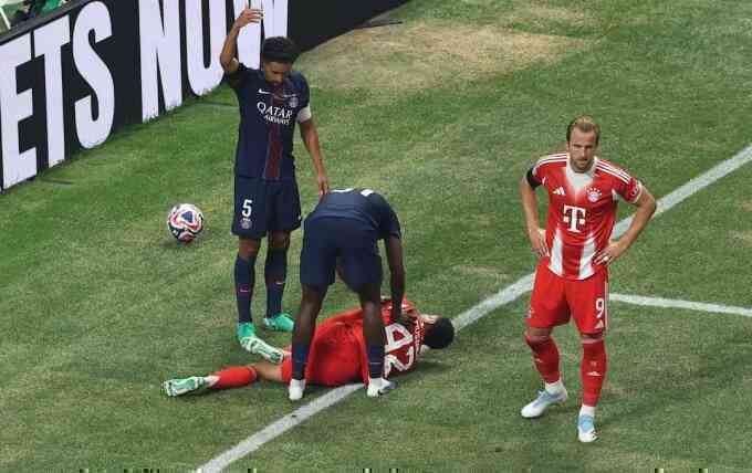 Kompany giận `sôi máu` vì Musiala gãy chân