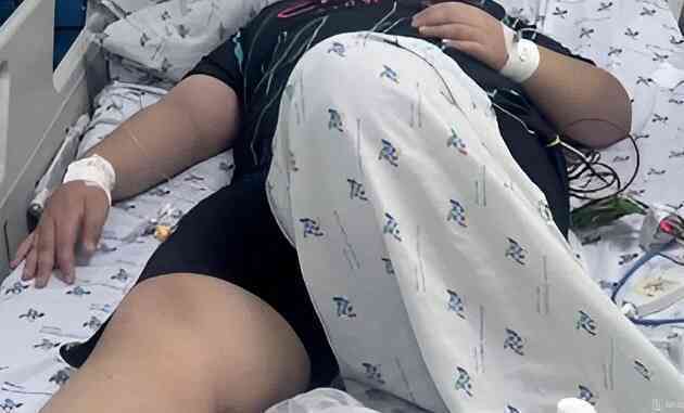 Bé trai béo phì nguy kịch sau ba ngày sốt cao