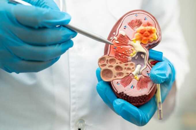 5 thói quen tưởng tốt hóa ra hại thận