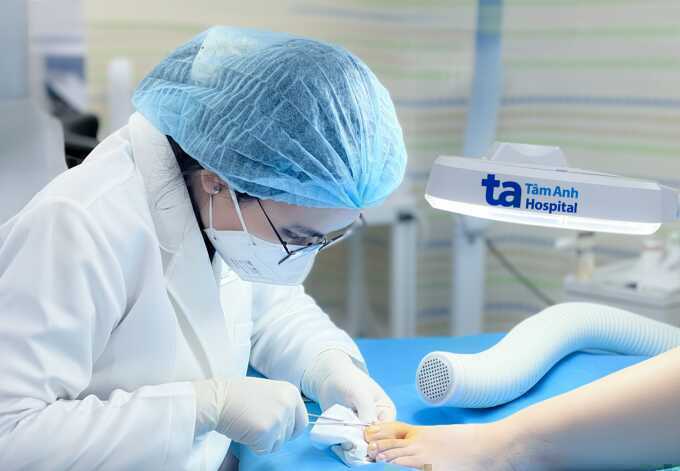 Viêm móng chân sau làm nail