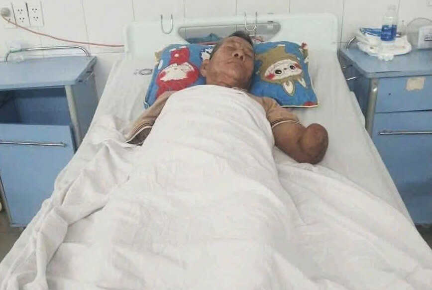 Tình trạng sức khỏe cụ ông sau khi kẹp con rắn hổ mang cắn mình về nhà